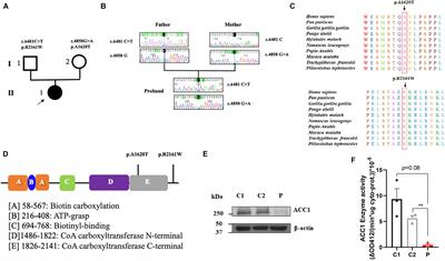 Biallelic Mutations in ACACA Cause a Disruption in Lipid Homeostasis That Is Associated With Global Developmental Delay, Microcephaly, and Dysmorphic Facial Features